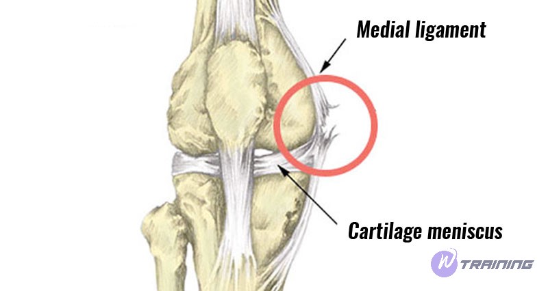 illustrator of sprain knee